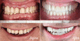 Slider image (8) CHC Clinica Dental in Barcelona Spain